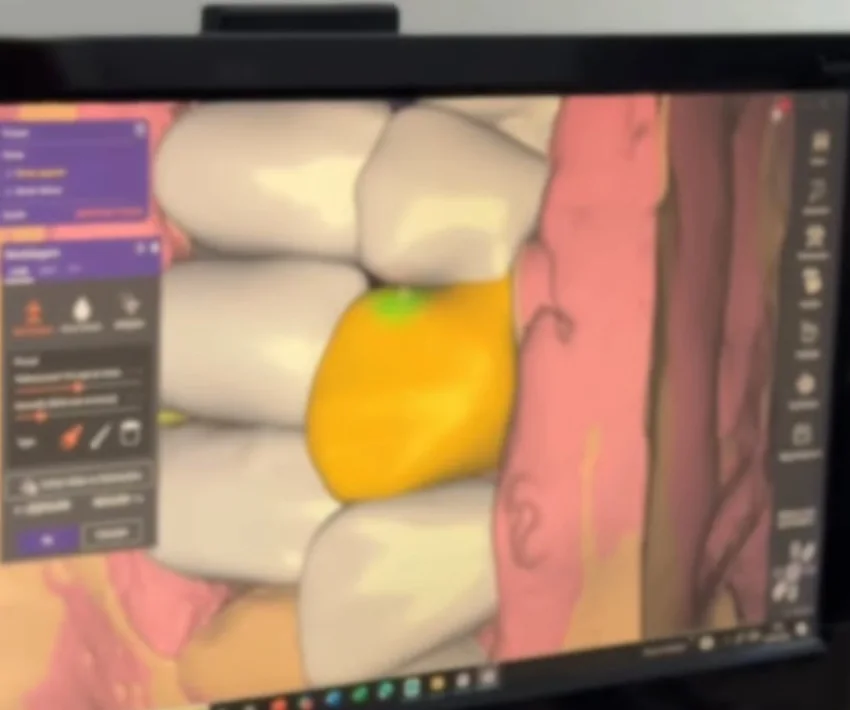 Tela de computador com o desenho digital de peças dentárias